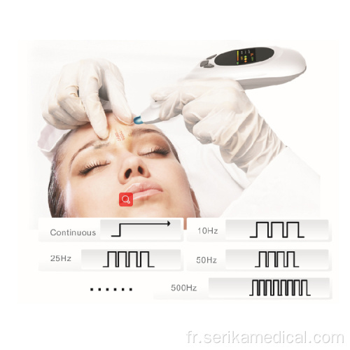 stylo à plasma de fibroblastation pour cicatrices